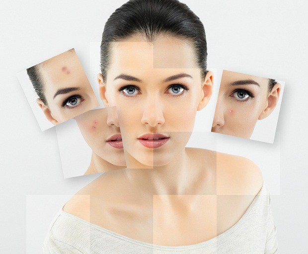 How to Reduce Age Spots and Discoloration