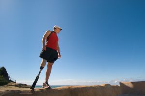 A athlete with a prosthetic leg looking towards the ocean.