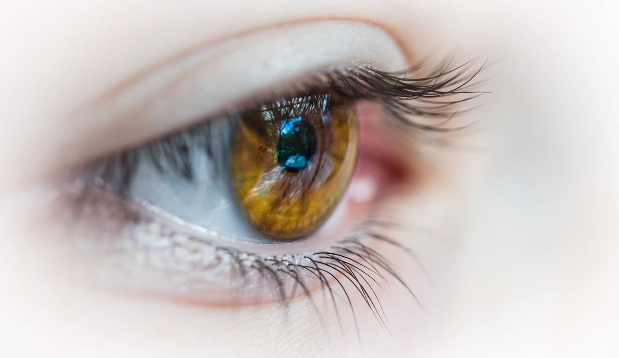 Itchy or irritated Eyes?  It May Be Blepharitis