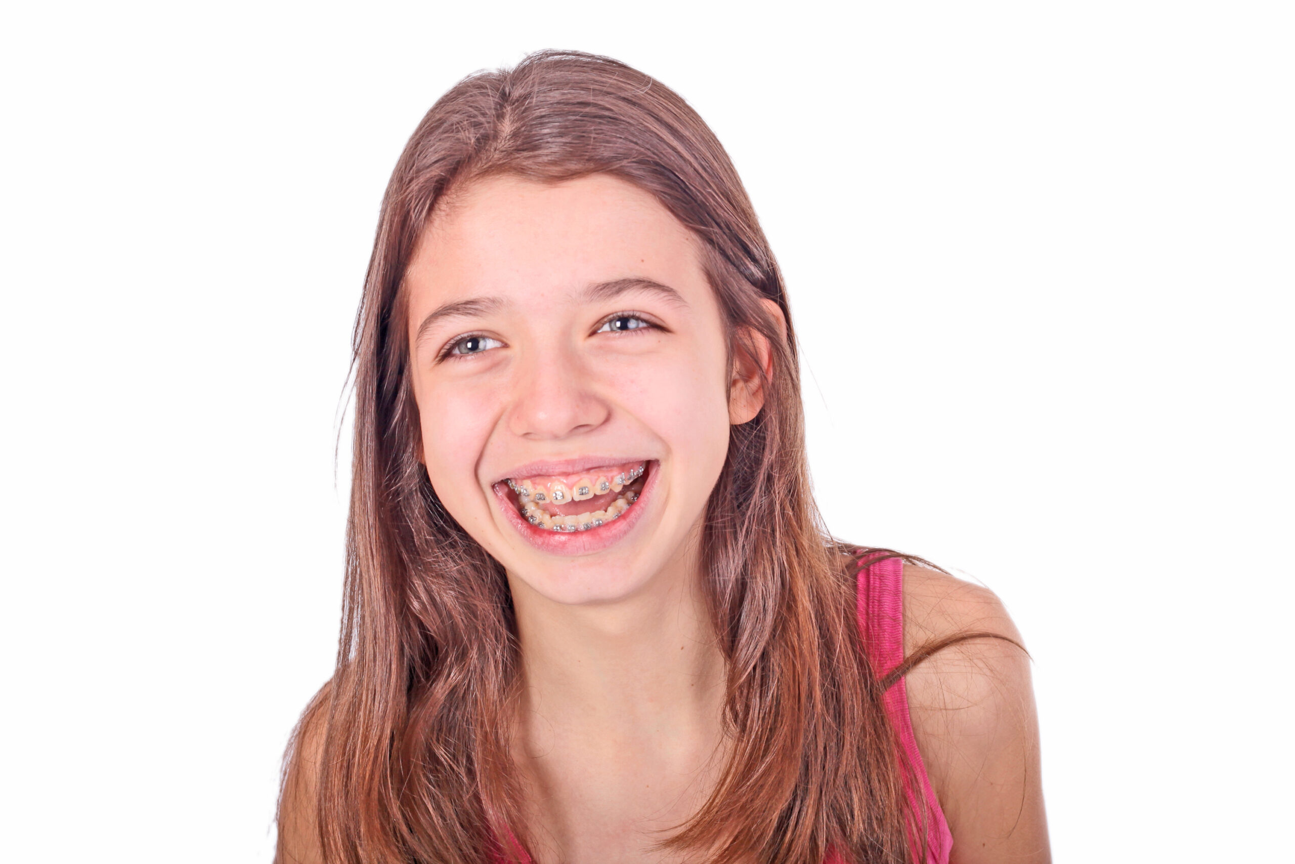 Orthodontic Options: How to Choose the Best Braces for You
