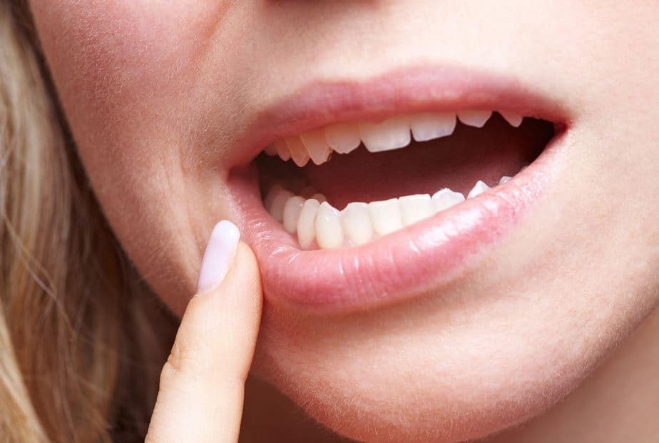 Pulling Teeth: How to Overcome Your Fear of a Tooth Extraction