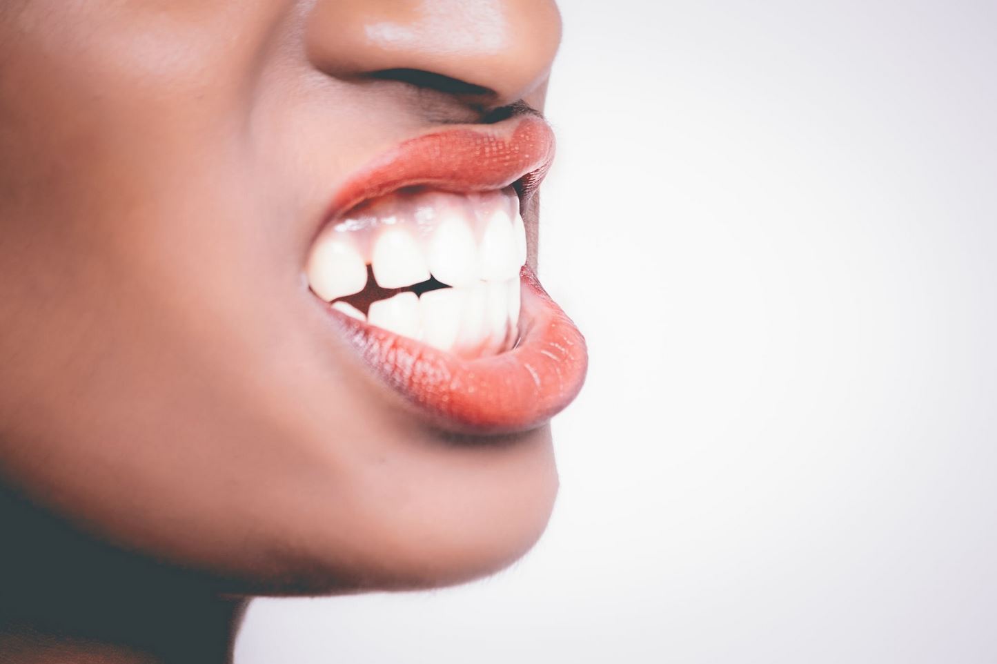 4 Reasons to Straighten Your Teeth for Better Oral Health