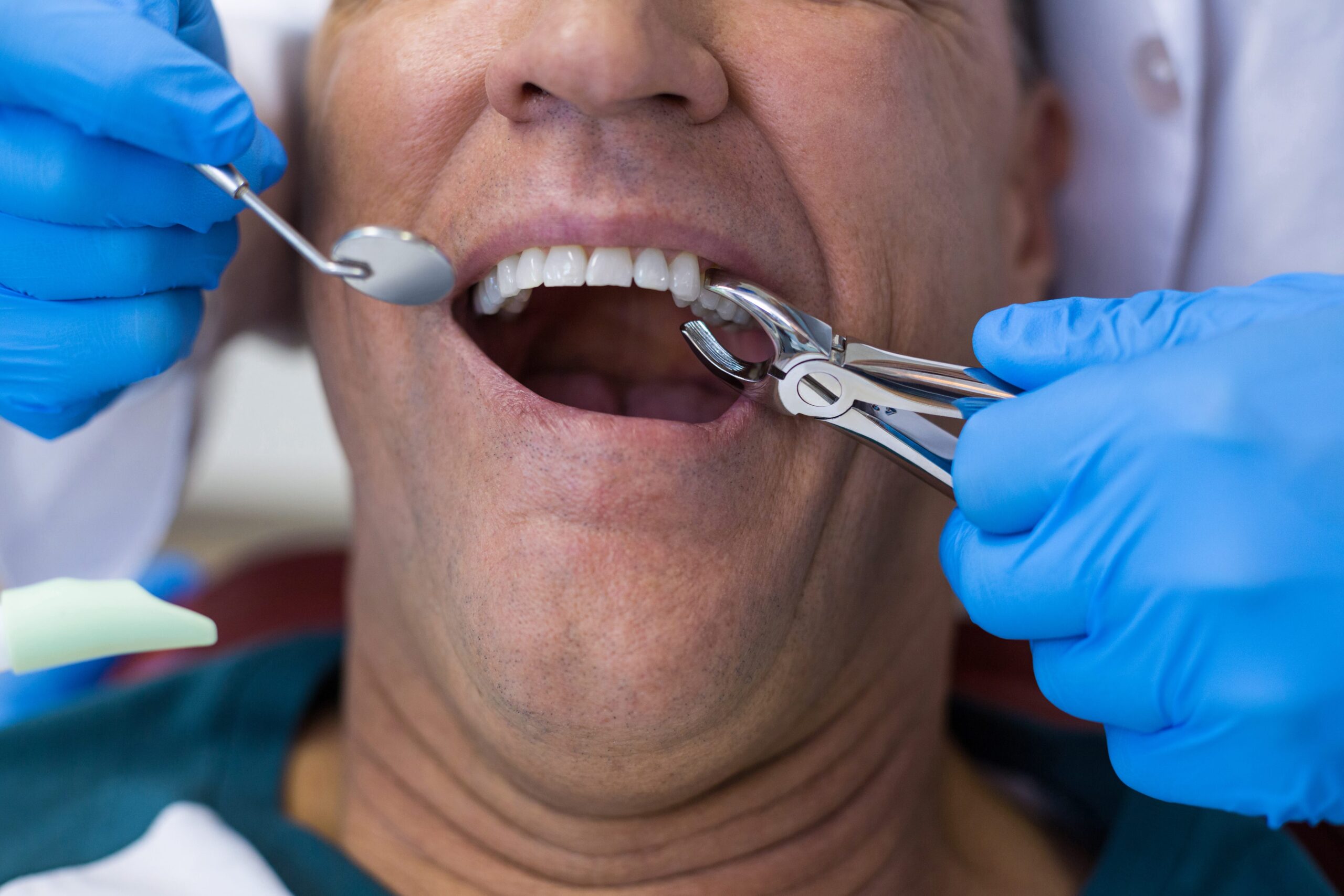 What To Look For When Choosing An Implant Dentist