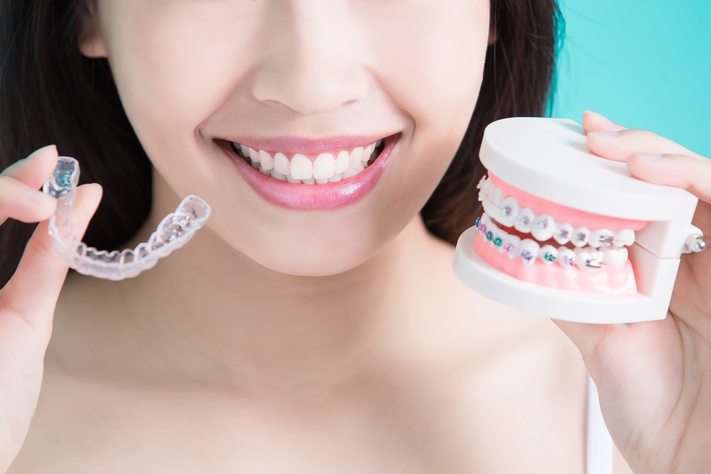 How To Protect Your Smile While Wearing Braces
