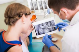 shutterstock 226929574 300x200 - What To Expect In A Great Dental Implant Center