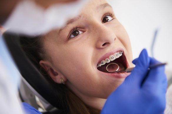 girl with braces during routine dental examination